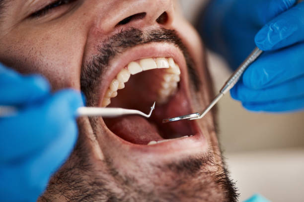 Best Emergency Broken Tooth Repair in Choctaw Lake, OH
